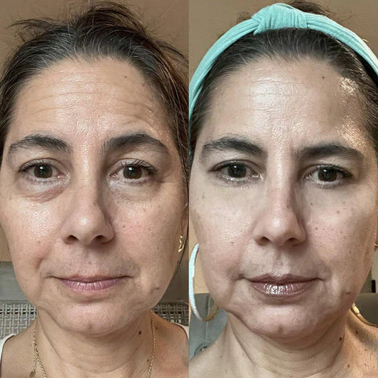 Exos Serum
